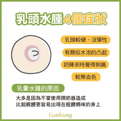 女生乳暈大|大乳暈不美觀怎麼辦？了解乳暈變大的原因